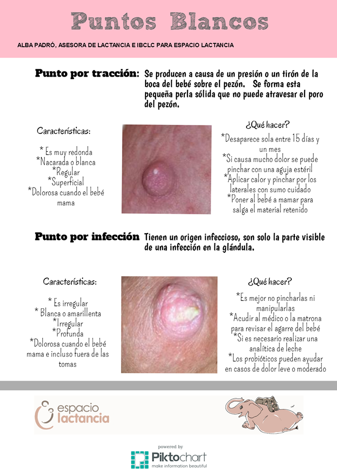 Aumentar el pecho en minske el precio